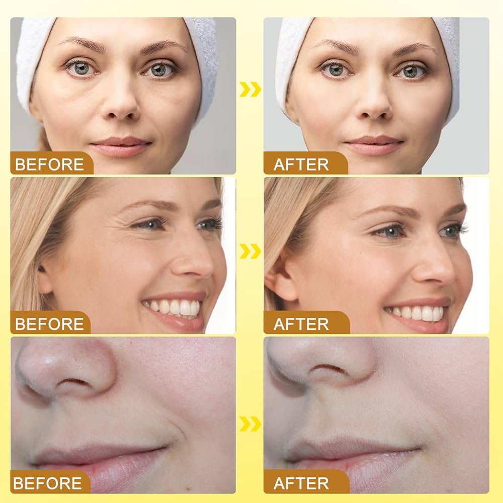 CREMA DE BOTOX VENENO DE ABEJA ANTI ARRUGAS