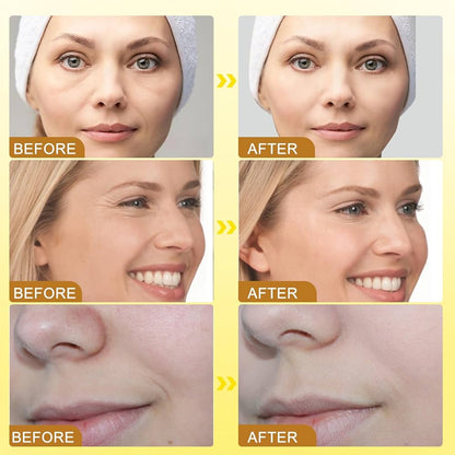 CREMA DE BOTOX VENENO DE ABEJA ANTI ARRUGAS
